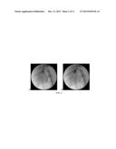 NITRATED CARDIAC TROPONIN I AS A BIOMARKER OF CARDIAC ISCHEMIA diagram and image