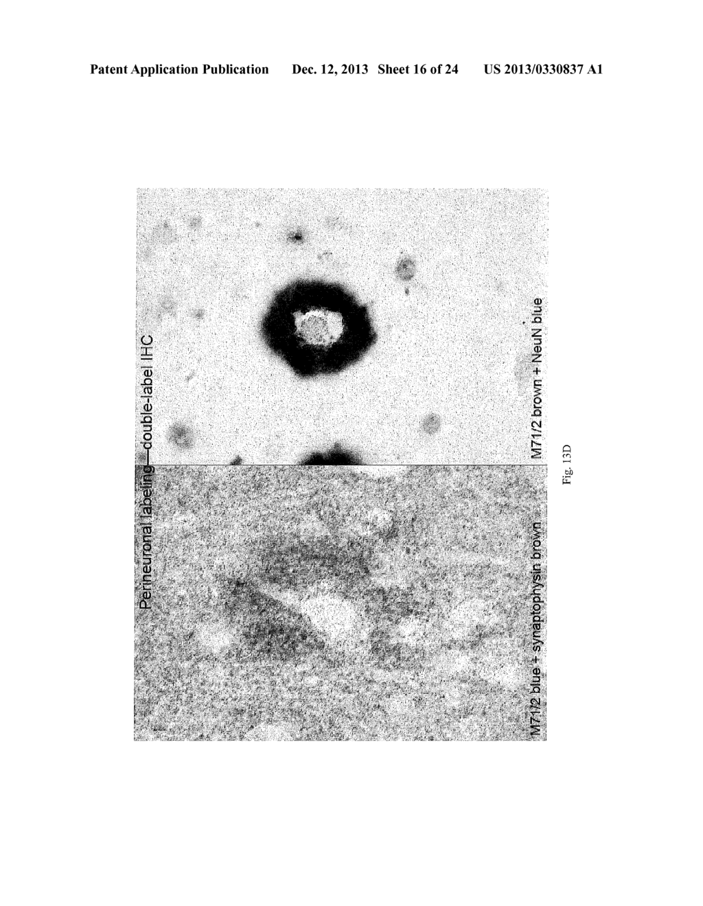 MONOCLONAL ANTIBODIES THAT TARGET PATHOLOGICAL ASSEMBLIES OF AMYLOID BETA     (ABETA) - diagram, schematic, and image 17