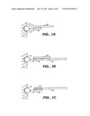 DETECTION OF NUCLEIC ACID REACTIONS ON BEAD ARRAYS diagram and image