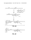 DETECTION OF NUCLEIC ACID REACTIONS ON BEAD ARRAYS diagram and image