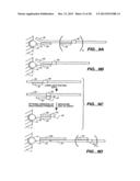 DETECTION OF NUCLEIC ACID REACTIONS ON BEAD ARRAYS diagram and image