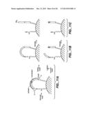 DETECTION OF NUCLEIC ACID REACTIONS ON BEAD ARRAYS diagram and image