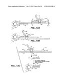 DETECTION OF NUCLEIC ACID REACTIONS ON BEAD ARRAYS diagram and image