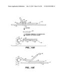 DETECTION OF NUCLEIC ACID REACTIONS ON BEAD ARRAYS diagram and image