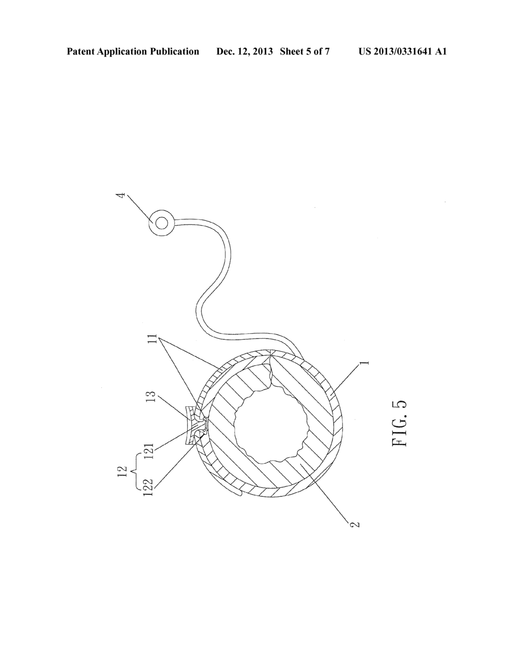 GASTRIC BAND FOR LAPAROSCOPIC GASTRIC BANDING - diagram, schematic, and image 06