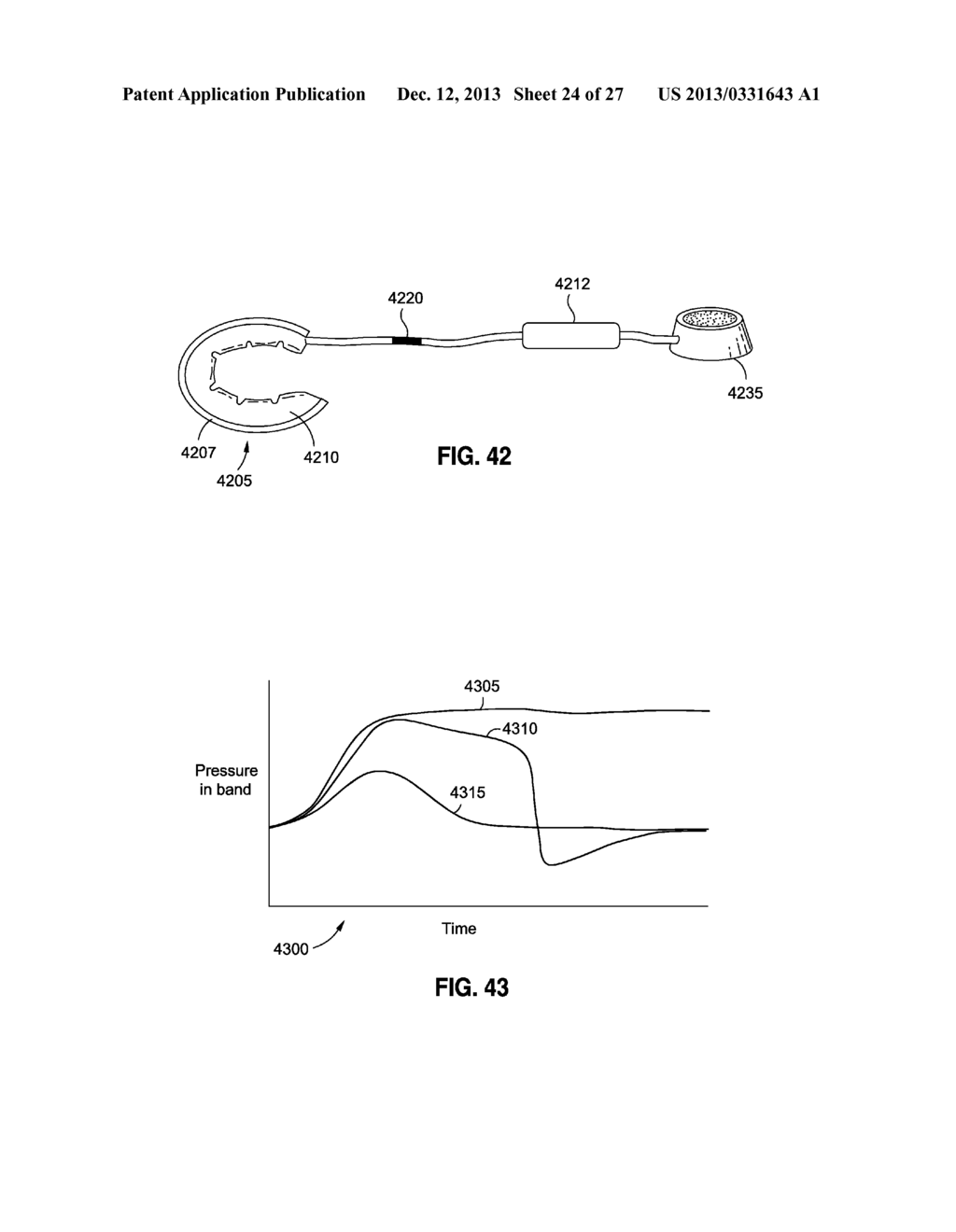 SELF-ADJUSTING GASTRIC BAND - diagram, schematic, and image 25