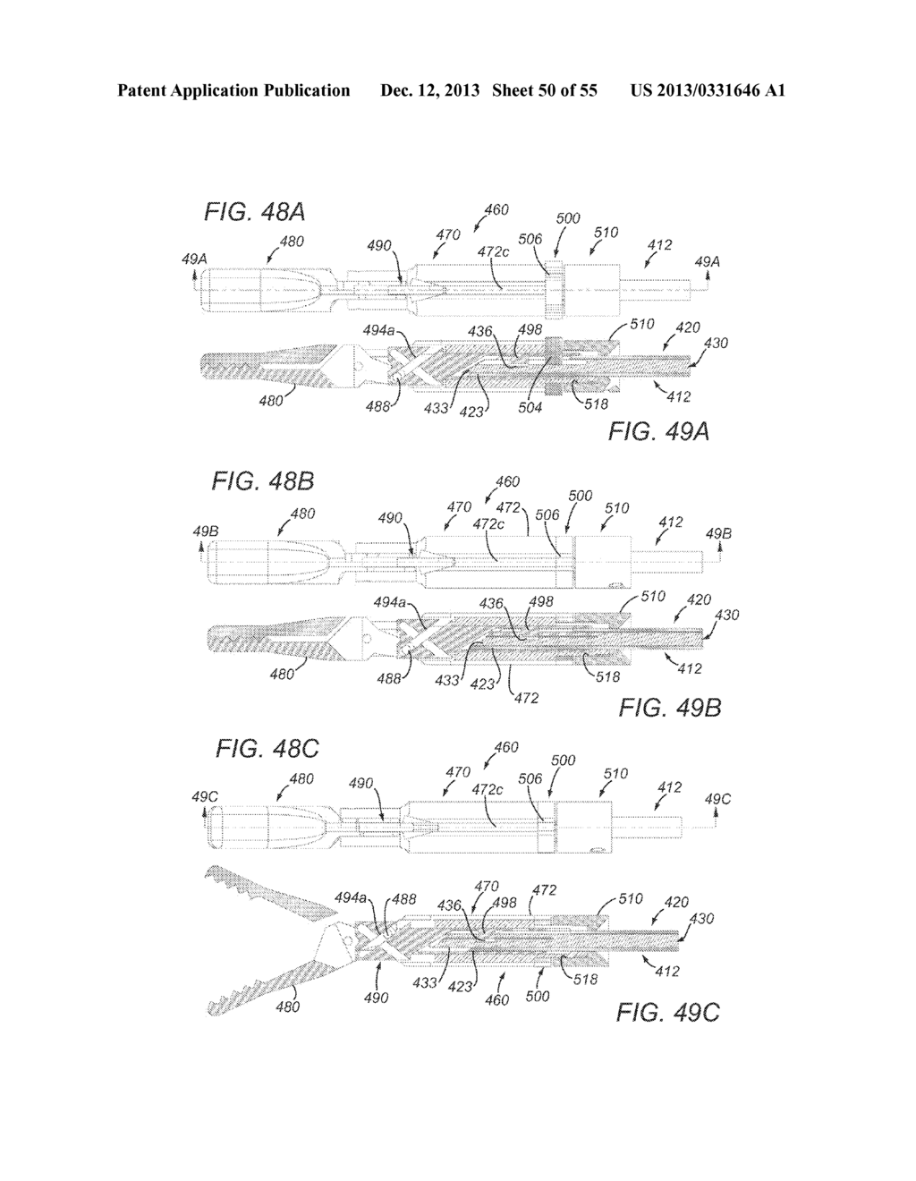 APPARATUS, SYSTEMS, AND METHODS FOR PERFORMING LAPAROSCOPIC SURGERY - diagram, schematic, and image 51