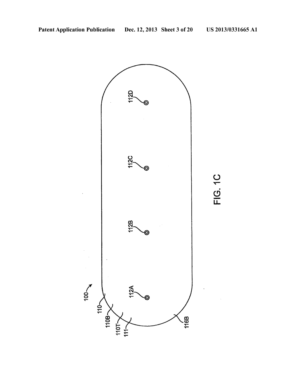 SYSTEM AND METHODS FOR WIRELESS BODY FLUID MONITORING - diagram, schematic, and image 04