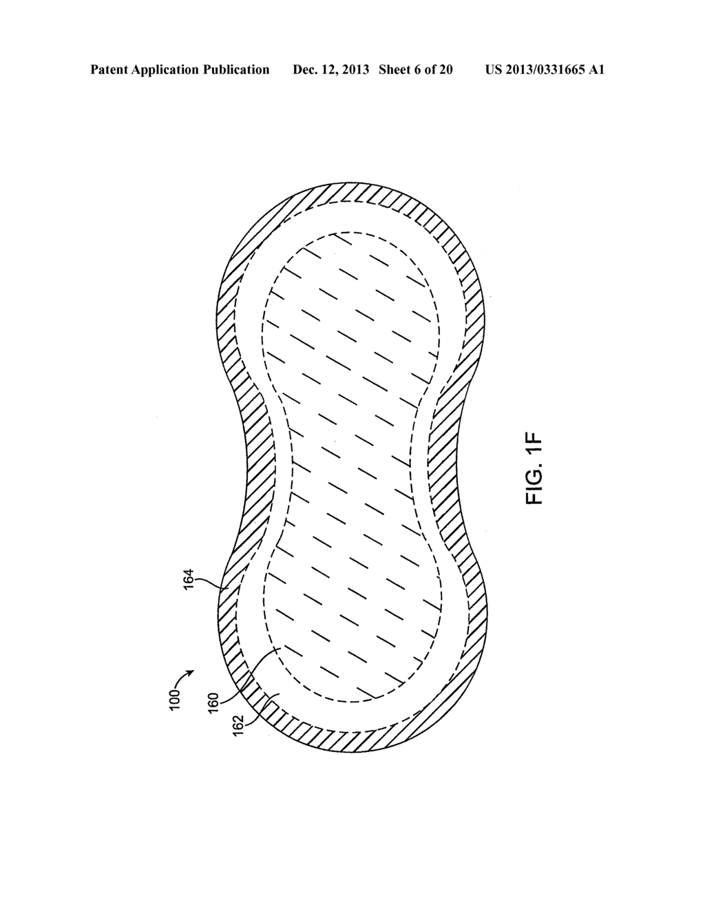 SYSTEM AND METHODS FOR WIRELESS BODY FLUID MONITORING - diagram, schematic, and image 07