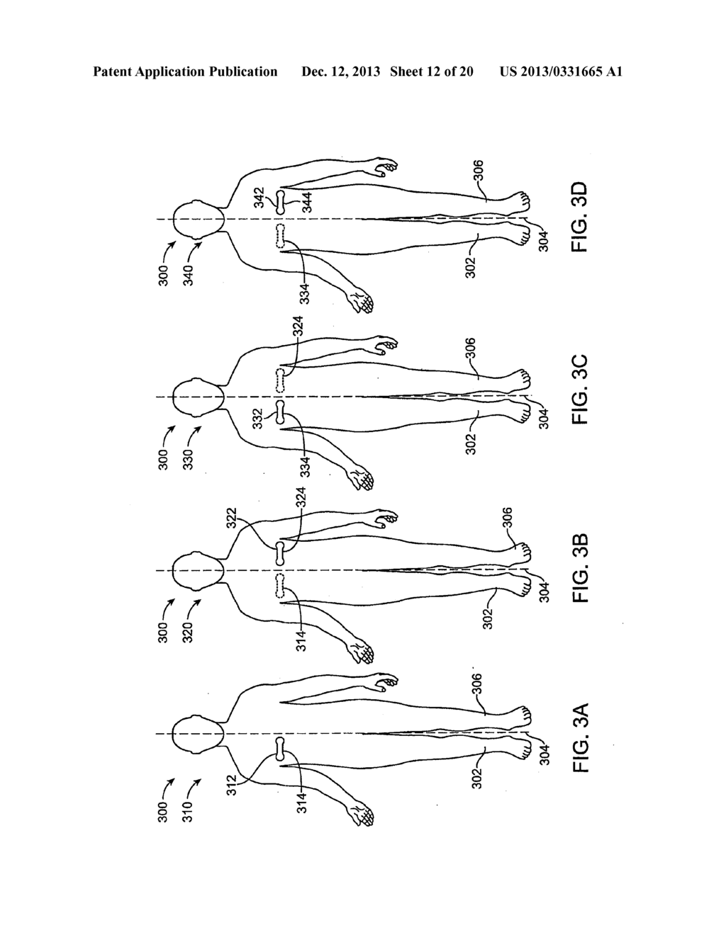 SYSTEM AND METHODS FOR WIRELESS BODY FLUID MONITORING - diagram, schematic, and image 13
