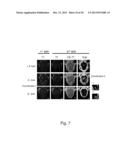 NEURONAVIGATION-GUIDED FOCUSED ULTRASOUND SYSTEM AND METHOD THEREOF diagram and image