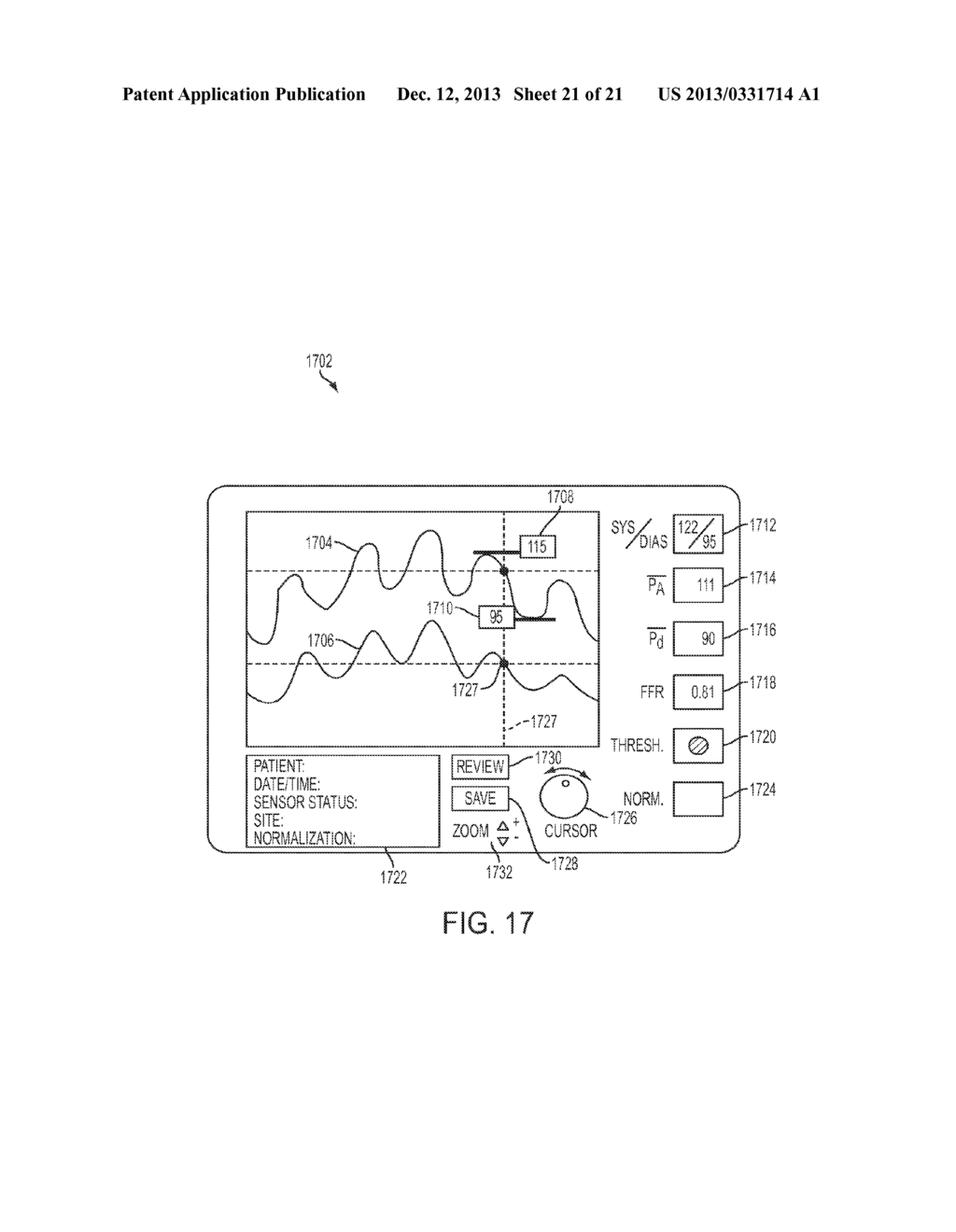 PHYSIOLOGICAL SENSOR DELIVERY DEVICE AND METHOD - diagram, schematic, and image 22