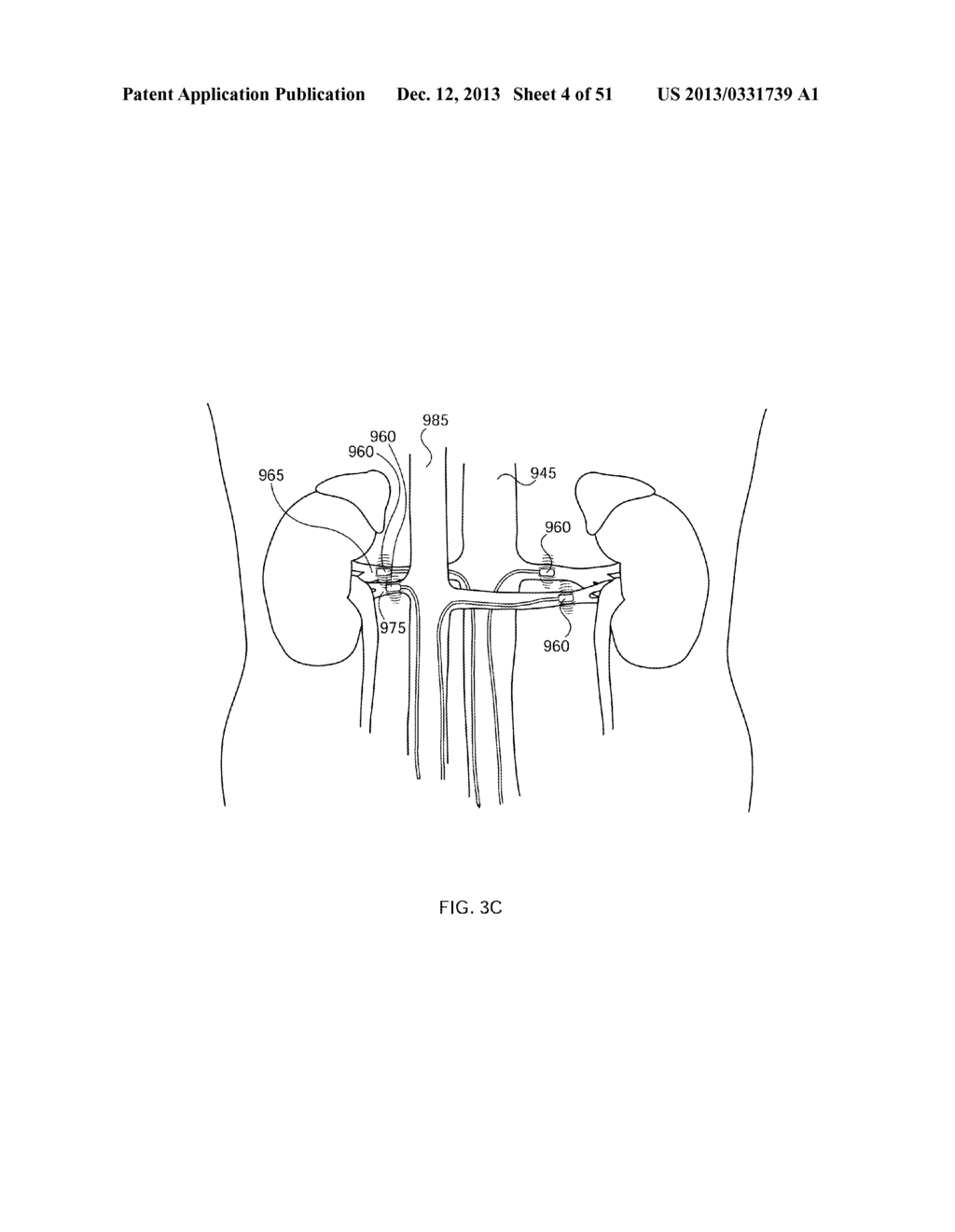 ENERGETIC MODULATION OF NERVES - diagram, schematic, and image 05