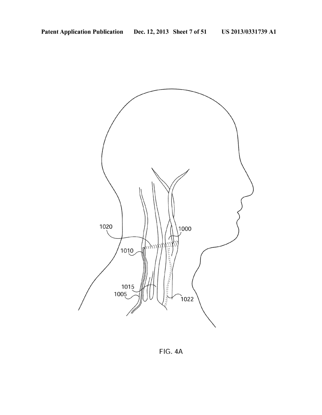 ENERGETIC MODULATION OF NERVES - diagram, schematic, and image 08