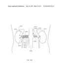 ENERGETIC MODULATION OF NERVES diagram and image