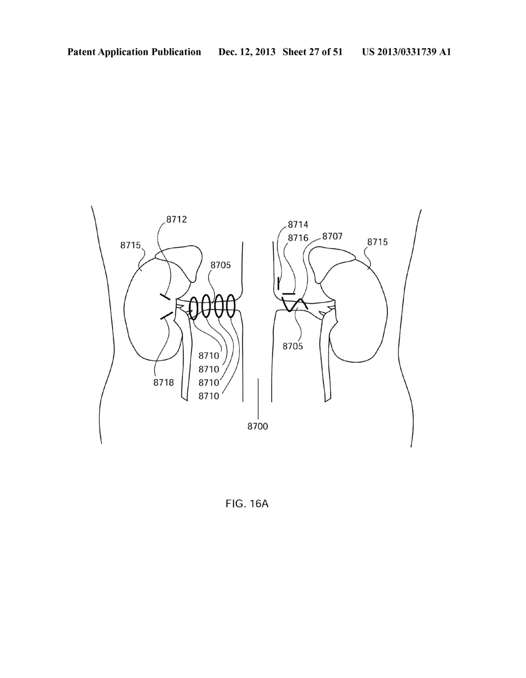 ENERGETIC MODULATION OF NERVES - diagram, schematic, and image 28