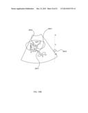 ENERGETIC MODULATION OF NERVES diagram and image