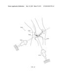 ENERGETIC MODULATION OF NERVES diagram and image