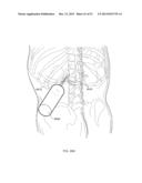 ENERGETIC MODULATION OF NERVES diagram and image