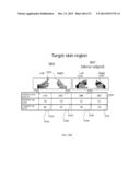 ENERGETIC MODULATION OF NERVES diagram and image