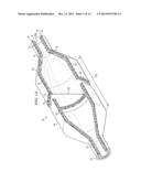 NON-COMPLIANT MEDICAL BALLOON HAVING AN INTEGRAL NON-WOVEN FABRIC LAYER diagram and image