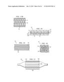 NON-COMPLIANT MEDICAL BALLOON HAVING AN INTEGRAL NON-WOVEN FABRIC LAYER diagram and image