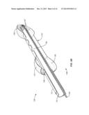 Recovery Catheter Assembly and Method diagram and image