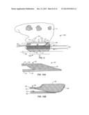 Recovery Catheter Assembly and Method diagram and image