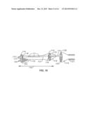 Recovery Catheter Assembly and Method diagram and image