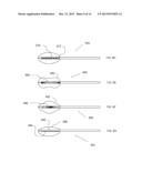 CRYOABLATION APPARATUS WITH ENHANCED HEAT EXCHANGE AREA AND RELATED METHOD diagram and image