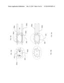 CRYOABLATION APPARATUS WITH ENHANCED HEAT EXCHANGE AREA AND RELATED METHOD diagram and image