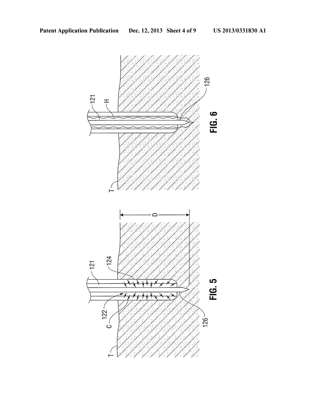 ELECTROSURGICAL DISSECTOR WITH THERMAL MANAGEMENT - diagram, schematic, and image 05