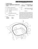 ELECTRODE CATHETER DEVICE diagram and image