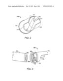 TISSUE RESECTION DEVICE AND RELATED METHODS OF USE diagram and image