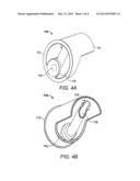 TISSUE RESECTION DEVICE AND RELATED METHODS OF USE diagram and image