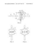 Method and Device for Percutaneous Valve Annuloplasty diagram and image