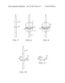 Method and Device for Percutaneous Valve Annuloplasty diagram and image