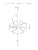 Method and Device for Percutaneous Valve Annuloplasty diagram and image