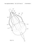 Method and Device for Percutaneous Valve Annuloplasty diagram and image