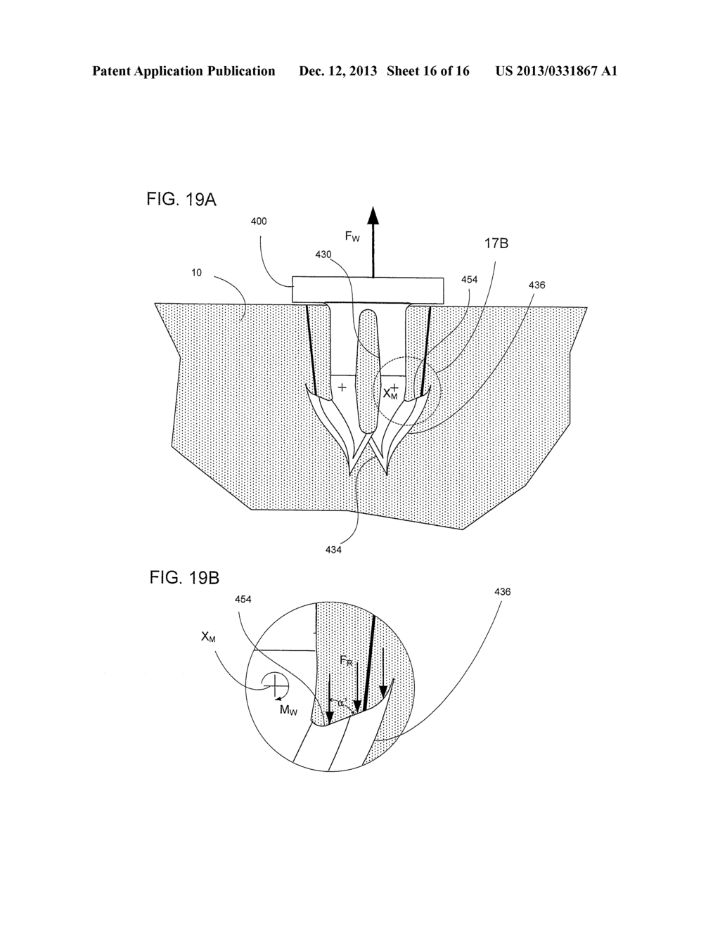 Multiple Leg Surgical Fastener - diagram, schematic, and image 17