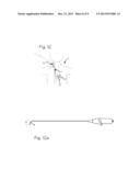 Method of Implanting a PFO Occluder in a Patient diagram and image