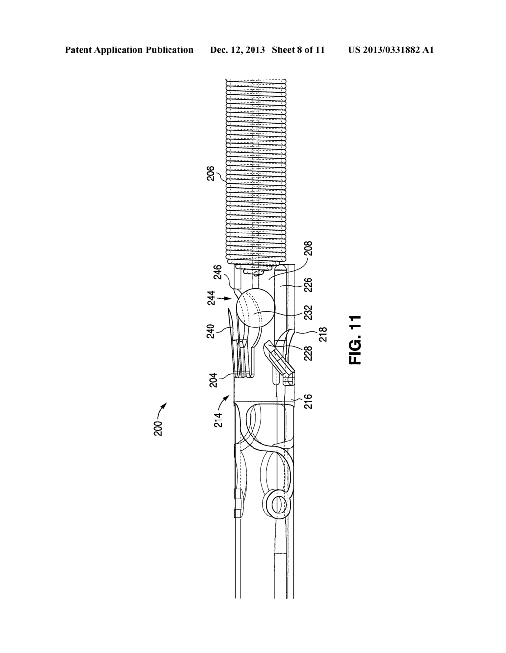 EMBOLIC COIL IMPLANT SYSTEM AND IMPLANTATION METHOD - diagram, schematic, and image 09