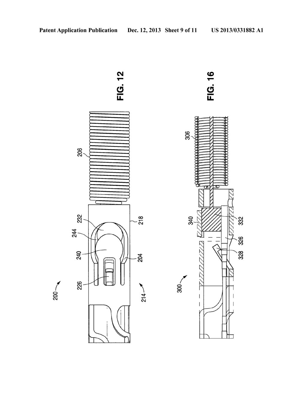 EMBOLIC COIL IMPLANT SYSTEM AND IMPLANTATION METHOD - diagram, schematic, and image 10