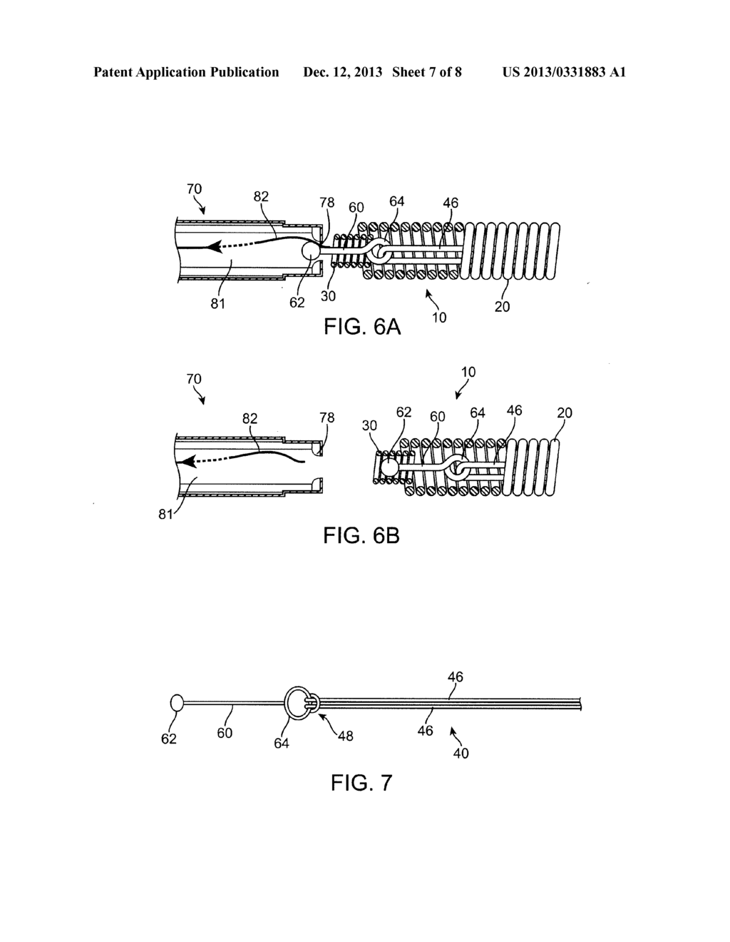 IMPLANT INCLUDING A COIL AND A STRETCH-RESISTANT MEMBER - diagram, schematic, and image 08