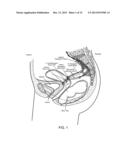 DEVICES AND METHODS FOR STIMULATING NERVES diagram and image