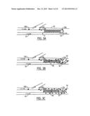 SYSTEMS AND METHODS FOR INTRAVASCULAR COOLING diagram and image