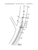 SYSTEMS AND METHODS FOR INTRAVASCULAR COOLING diagram and image