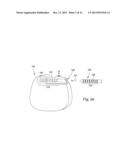 ANCHORING UNITS FOR LEADS OF IMPLANTABLE ELECTRIC STIMULATION SYSTEMS AND     METHODS OF MAKING AND USING diagram and image