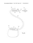 ANCHORING UNITS FOR LEADS OF IMPLANTABLE ELECTRIC STIMULATION SYSTEMS AND     METHODS OF MAKING AND USING diagram and image