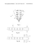 ANCHORING UNITS FOR LEADS OF IMPLANTABLE ELECTRIC STIMULATION SYSTEMS AND     METHODS OF MAKING AND USING diagram and image